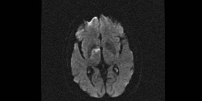 Robust Life Purpose as a Game-Changer