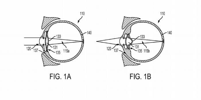 Google Wants to Improve Your Vision With a Device You Inject Into Your Eye