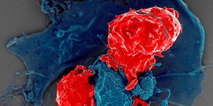 Kicking Pro-tumor Immune Cells Out of the Microenvironment