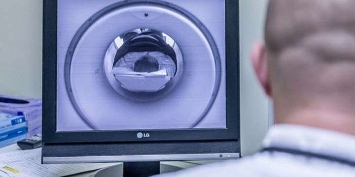 New Brain Scanner Technology For UC Berkeley