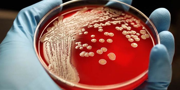 Salt Discovery Could Prevent Food Poisoning from MRSA