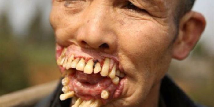 10 Scariest Diseases in the World