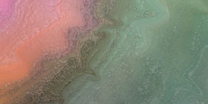 New Insights Into Down Syndrome