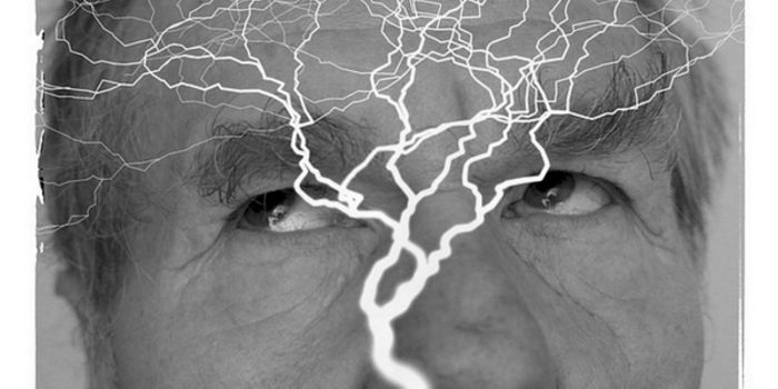 Mapping the Brain Before Surgery for Epilepsy