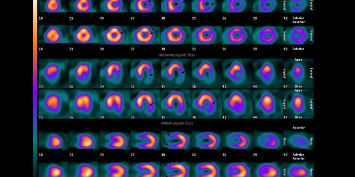 Nuclear Medicine: Origin, Crisis, and Renaissance