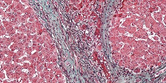 Testing for Liver Disease, Before Symptoms Appear