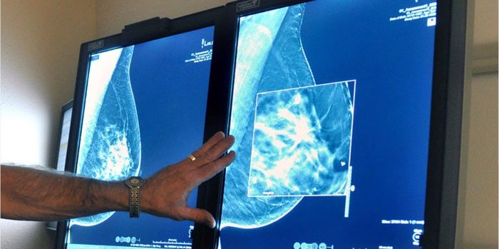 Detecting Breast Cancer Up to a Year Earlier