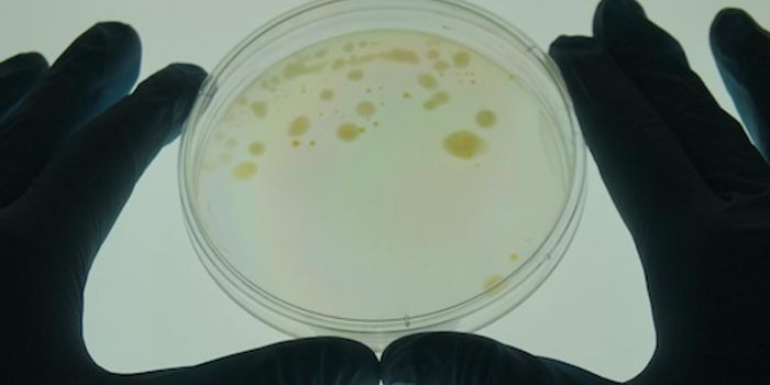 Beating Stress with Bacteria