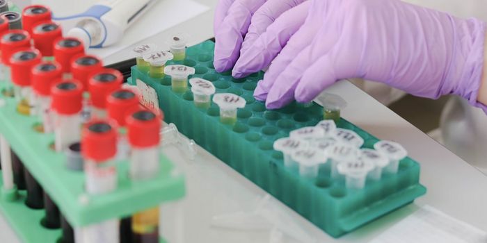 Advances in Spinal Muscular Atrophy Present Potential Treatment Options