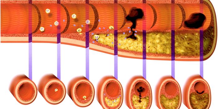 One Tiny RNA Could Break the Cycle of Arterial Thrombosis