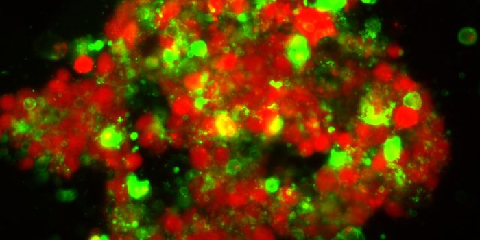 Mysterious lipids increase as cancer cells die