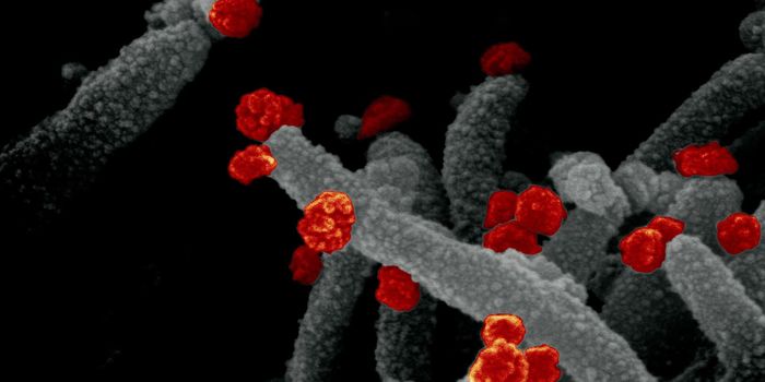 Focusing on the Cause of Neurological Symptoms of COVID-19