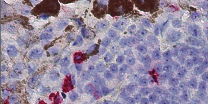 Increased Use of Tissue Data in Oncology: Enhancing Diagnostics, Cutting Costs & Improving Patient Lives