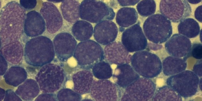 Preliminary Approval Issued for Personalized Cancer Therapy