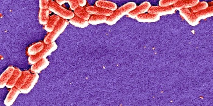 For the Second Time, Announcement of Superbug in US Patient