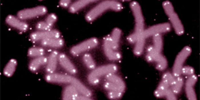 Genetic Risks Lurking for Melanoma? Telomeres may hold the key