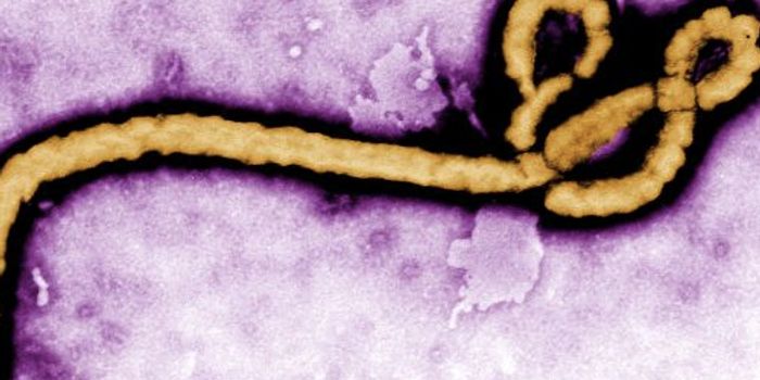 Progress in the Fight Against Ebola