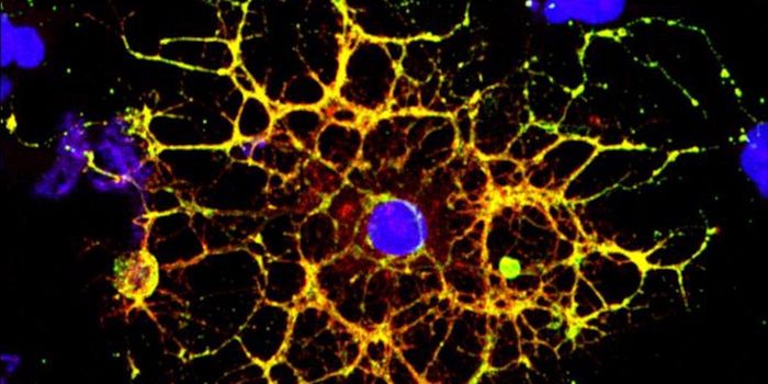 How HIV Can Deplete White Matter in the Brain