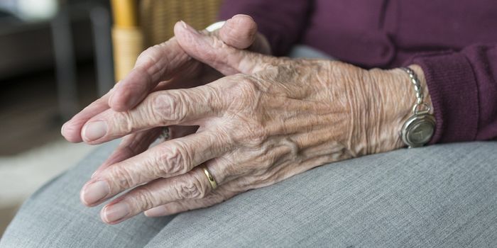 Understanding How Mitochondrial Dysfunction May Cause Parkinson's