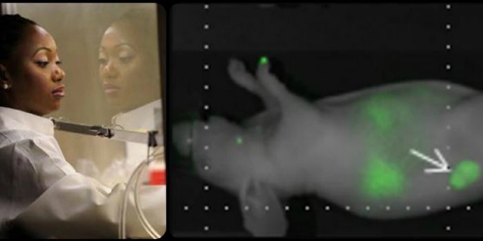 Laser-activated Nano-therapy Kills Cancer in Trials