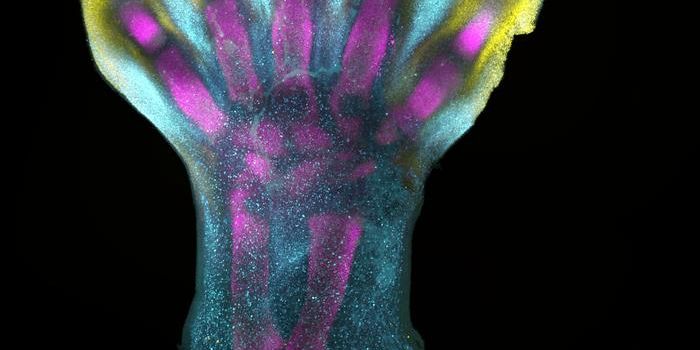 A Spectacular New Look at Human Limb Development