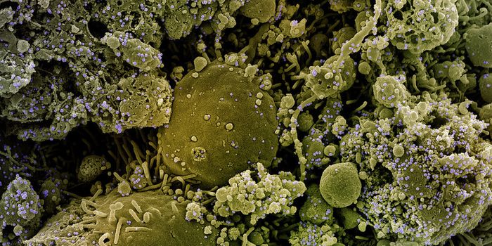 Some SARS-CoV-2 Mutations Help the Virus Invade the Brain