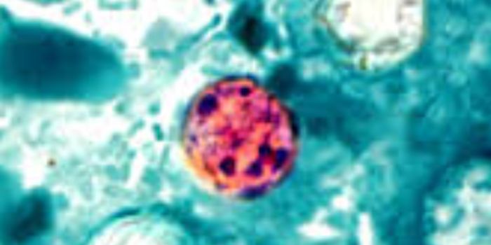 Cyclospora to Blame for Several Foodborne Outbreaks