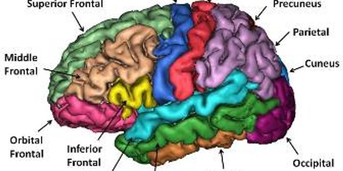 Researchers Call Brain Anatomy Differences Between Autistic  and Typically Developing Individuals Indistinguishable