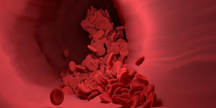 What is Polycythemia Vera?