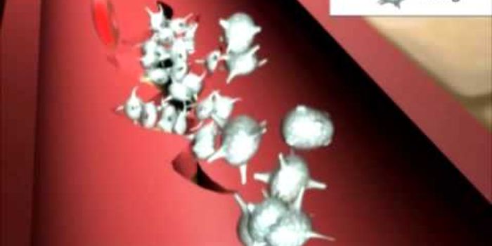 How does blood clot?