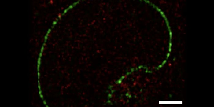 The Production & Export of Ribosomal Subunits is Caught on Video