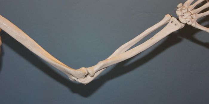 Breakthrough Drug Reduces Inflammation and Pain in Arthritis