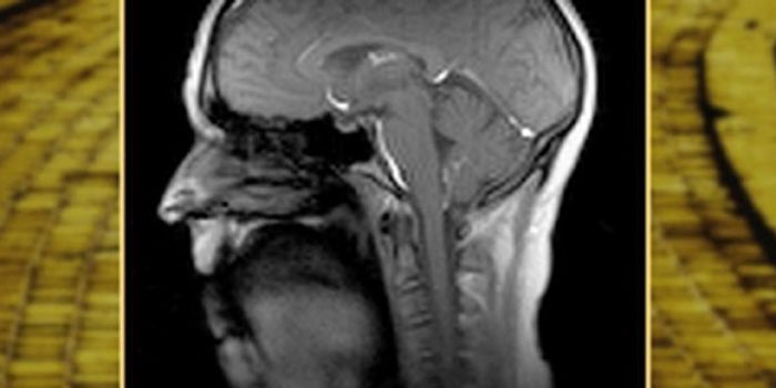 Demo of Hyper-Fast MRI Technique with Wizard of Oz (Brainy!) Tune