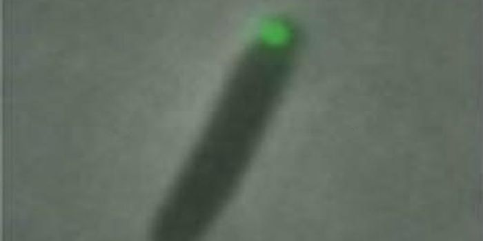 How Bacterial Cells Take out the Trash