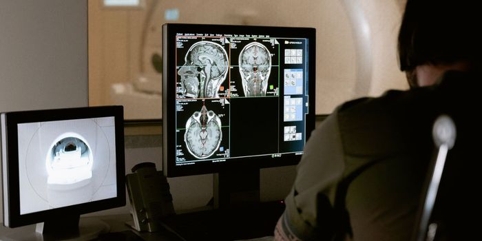 Gene Shows Promise as Therapeutic Target for Parkinson's