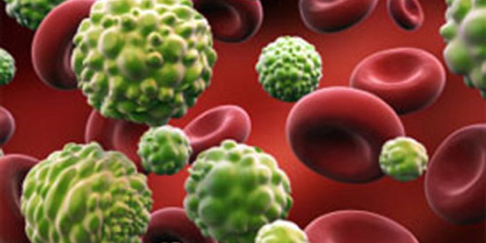 Acoustic Properties May Reveal Cancer Cell's Identity