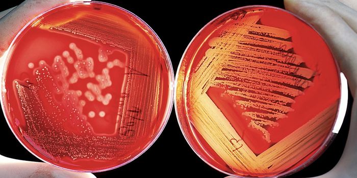 To Understand the Gut Microbiome, Researchers Create New Method to ID Strains