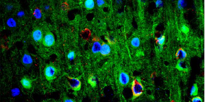Scientists Sequence Genome of Classical Hodgkin Lymphoma