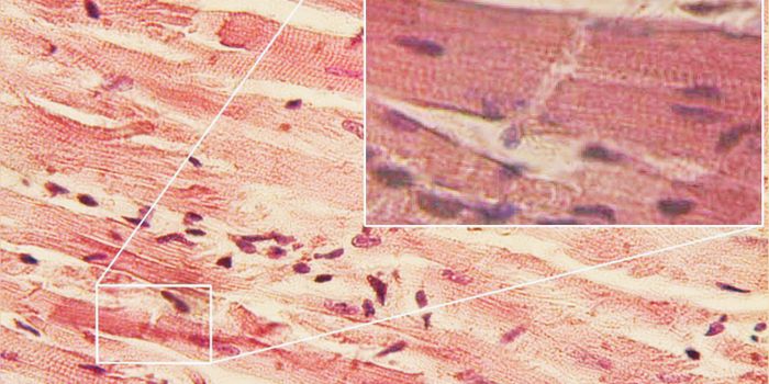 Protein Clusters Keep Heart Muscle Cells Beating in Sync