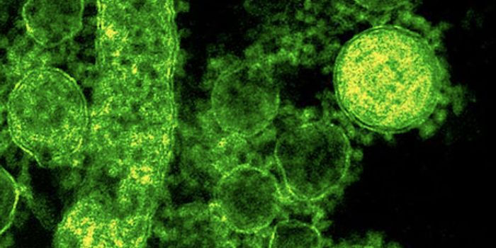 Deadly Virus Research Ban is Lifted