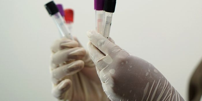 The First Alzheimer's Blood Test is Now FDA Approved