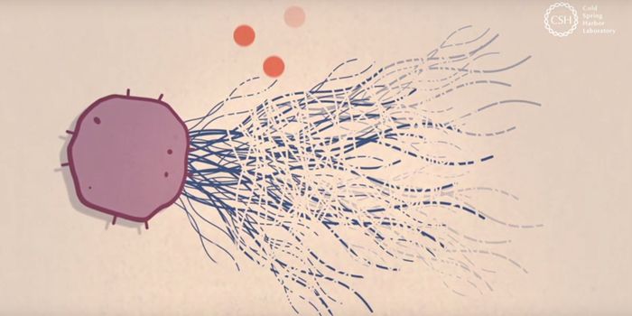 Worst COVID-19 Cases May be Caused by Immune Cell Overactivity