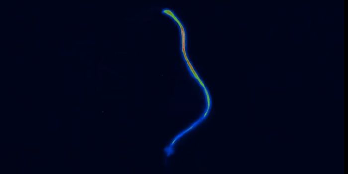 Acidic Stomach Environment May Worsen Microbial Pathogenicity