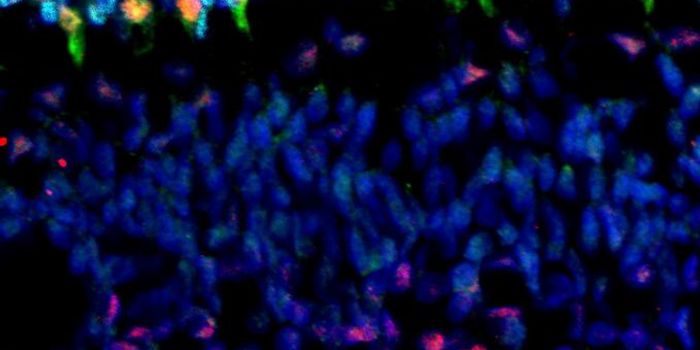 Stem Cells Lurking in Tumors Can Resist Treatment