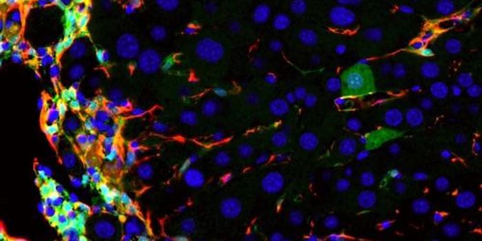 Cirrhosis-Causing Liver Cells Made Healthy in Mice