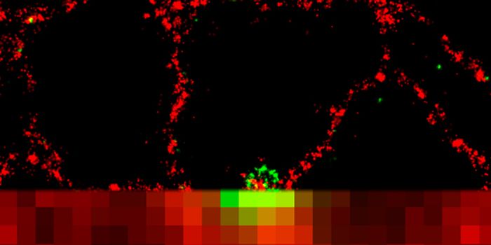 Powerful Microscopy Reveals More About Autophagy