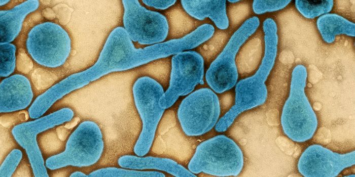 Two Cases of Deadly Marburg Virus Identified in Ghana