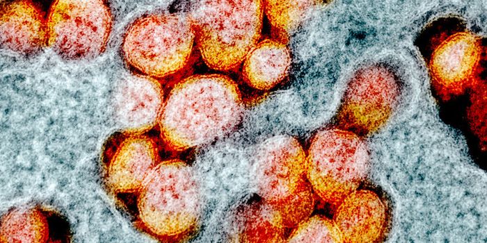 Allergies or Coronavirus? The Nose Knows