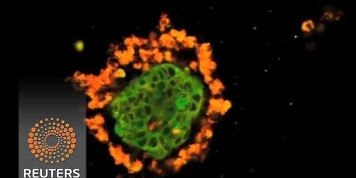 Tumors grown in dishes could help customize cancer treatment