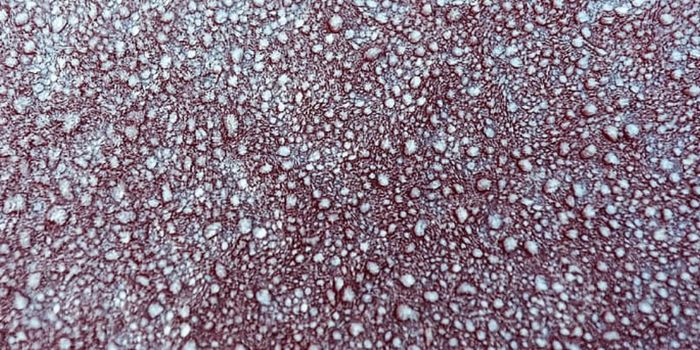 An Intriguing Triad - Gut Fungus, Immunity, and Behavior